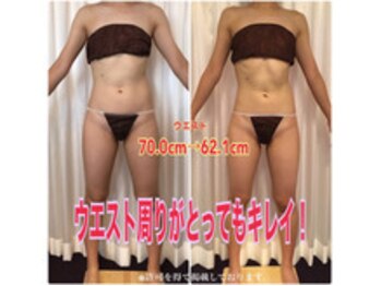 ボディエステティック アクアオーラ 富山店/ウエストが美しい！