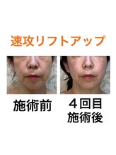 鍼灸サロンオランジュ 高槻富田院/