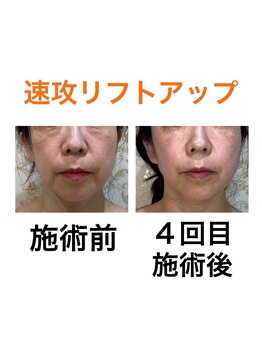 鍼灸サロンオランジュ 高槻富田院/