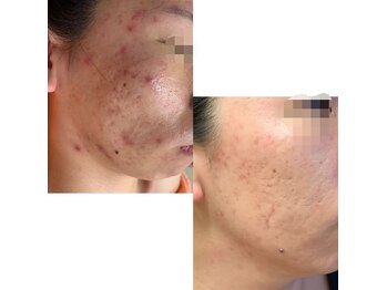 ディアナ(La Grand Belle Diana)/フェイシャルのお悩みは?