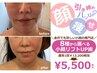 小顔人気NO1【小顔美顔】8種から選べる最先端小顔リフトアップ&肌管理¥5500
