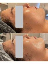 ビーメイクス(B・Makes)/ララピール