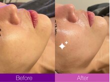 クレヴィア バイ サイバーエステ(CREBIA)/◎毛穴レス・ノーファンデ肌に◎