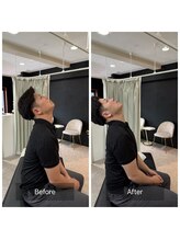ナオル整体 広島福山院(NAORU整体)/肩こり/首こり→Before/After