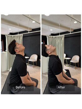 ナオル整体 広島福山院(NAORU整体)/肩こり/首こり→Before/After