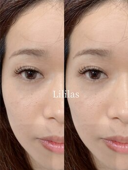 リリラース(Lililas)/