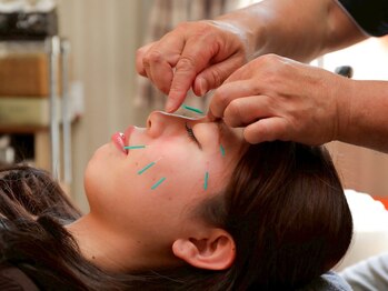 ながたともひさ指圧はり灸治療院/美容鍼の施術で小顔効果