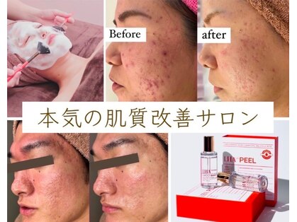 ホワイトカルム(White Calm)の写真