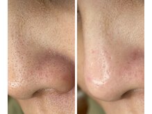 サイ(Sai)/before⇒after