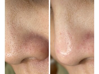 サイ(Sai)/before⇒after