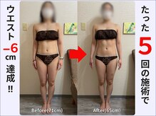 ぷりんす整体コージー(COZY)/【20代 女性】ビフォーアフター