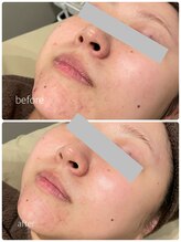 カイト(Kaito)/ハーブリプロ