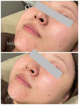 カイト(Kaito)/ハーブリプロ