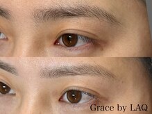 グレイス バイ ラク(Grace by LAQ)