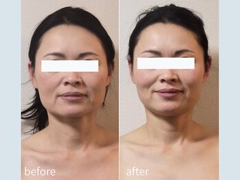 サロン ウル(salon Uru.)/３D立体小顔調整+マッサージ