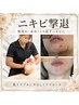 初回体験【繰り返すニキビ肌改善】ニキビ・赤み・跡を徹底改善¥15000→¥9800