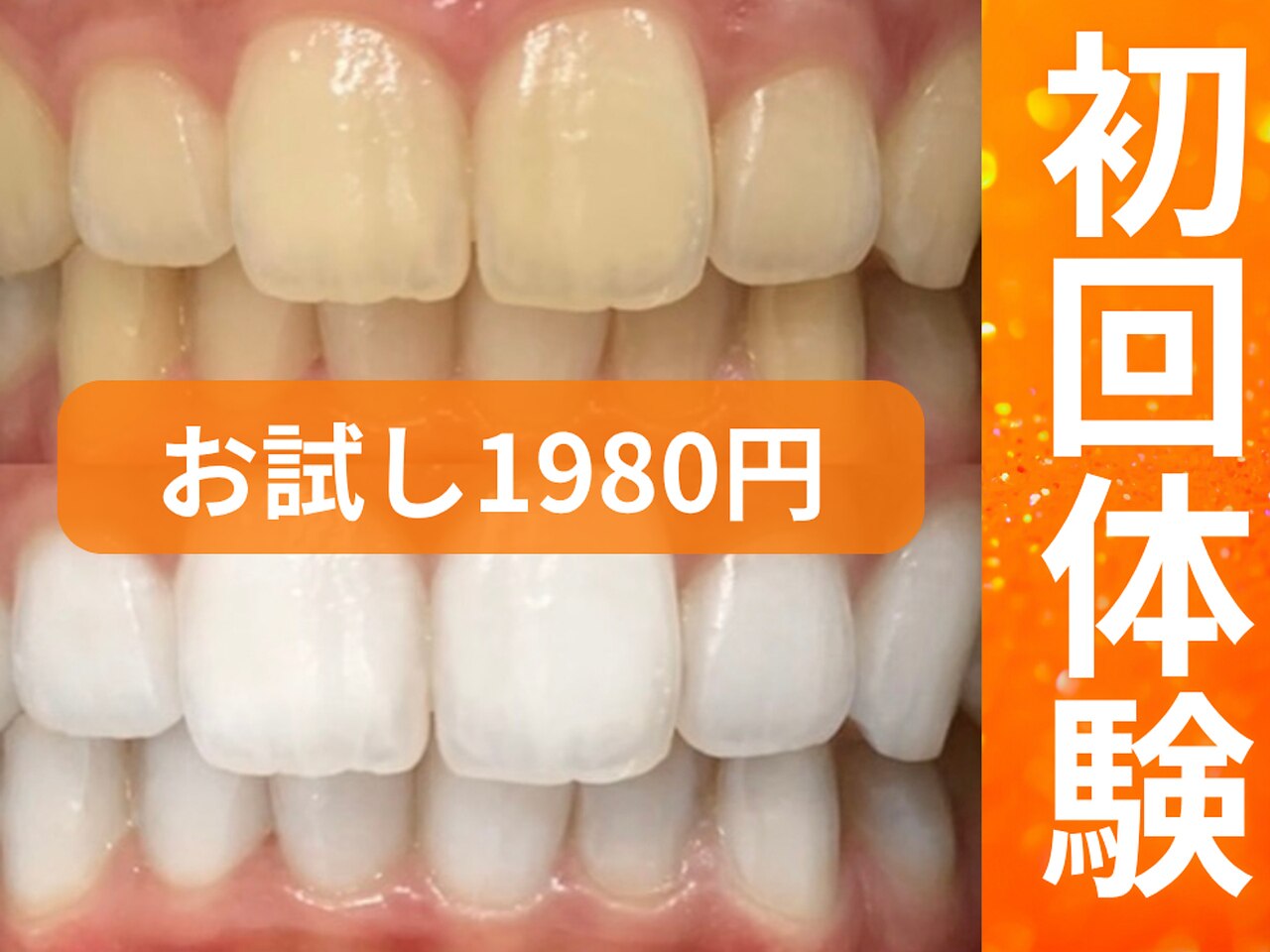 ホワイトニングセンター 富山二口店｜ホットペッパービューティー