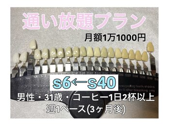 銀座deホワイトニング　/【お客様のビフォーアフター】