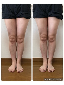足楽ほんぽ/美脚矯正コース