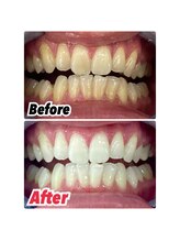 ホワイトニングスタイル 柏店&nbsp;専門店の 実力