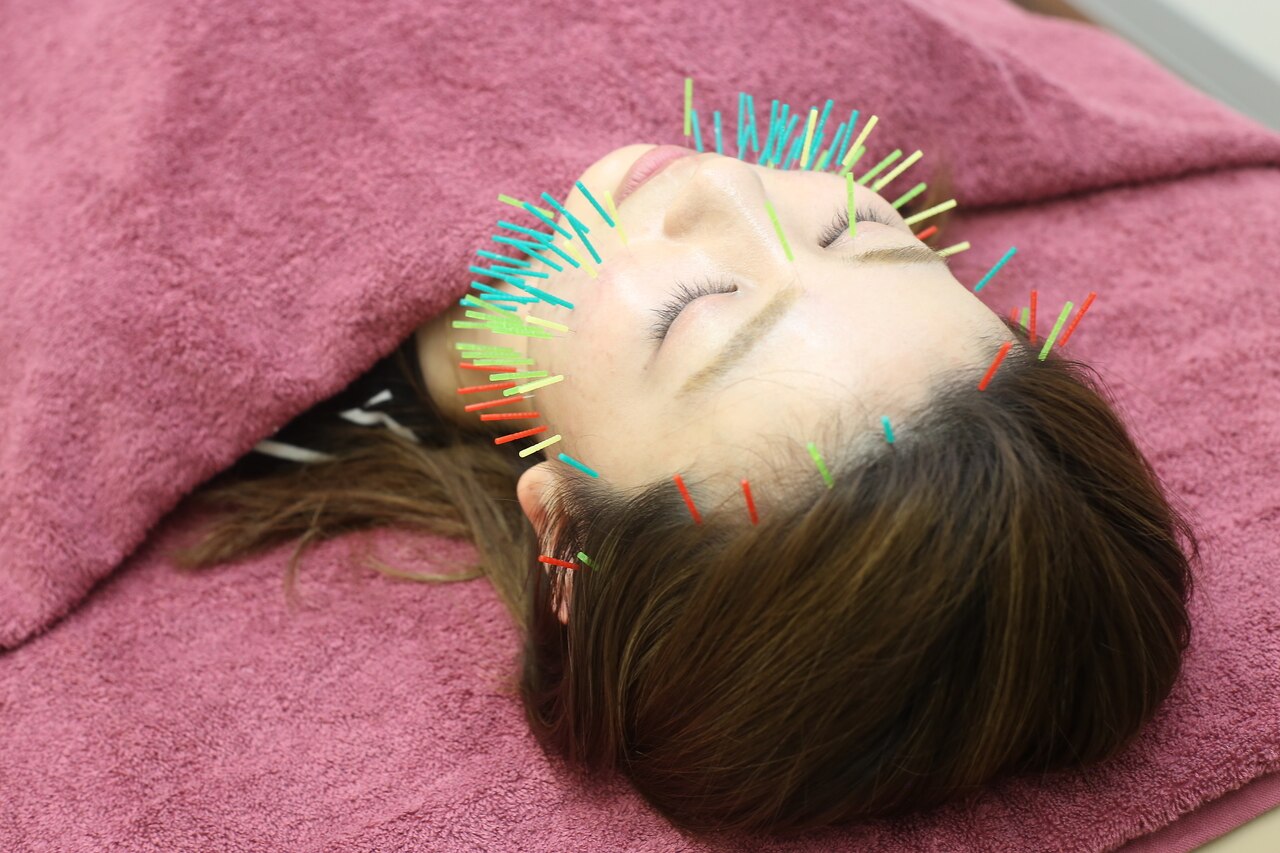 人気NO.1★整顔矯正【ハリネズミ美容鍼×小顔矯正×頭骨矯正】\22000→\9500