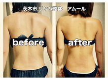 アムール(Amour)の雰囲気（こんな脚の人は腰痛に注意。元から改善して仰向きで寝られます）