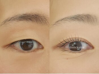 ウミカ(umica)/まぶたのリフトアップが叶う