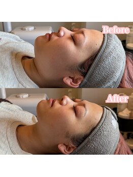 サロンドゥードゥー(SALON DOUDOU)/小顔ケア