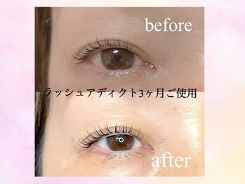 アンドアイビュー(&.ibeu)/ラッシュアディクトまつげパーマ