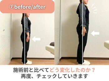 整体院カイト/施術後Before/After