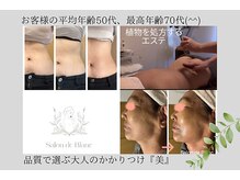 サロン ド ブラン(Salon de Blanc)