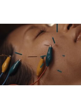 鍼灸施術を受けたい