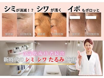 ソリシア(SORISIA)/ハリ・なめらかさを底上げ