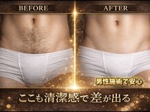 ドシースキンラボ 半蔵門四谷店(℃ SKIN LAB)の雰囲気(VIOは男性施術なのでしっかり男性の悩みも解決)