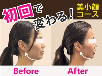 エンジェル(Angel)の写真/＼小顔×骨格専門サロン／本気でお悩みを改善するお客様のための一人専門サロン