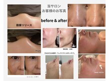 エンドット(EN.)の雰囲気（脂肪分解レモンbottle・究極の美肌ケア　インスタ→@EN.ENA3993）