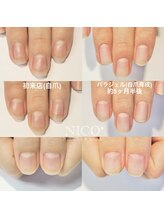 ニコプラス(NICO+)/自爪育成中