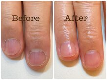 サロンR/地爪ケアでお爪本来の魅力を