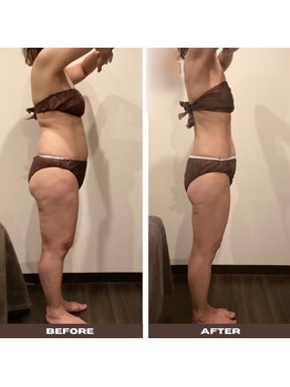 シェリーク 東京店/脂肪肝が改善！トータル-18キロ