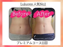 ヨサパーク ノア 星川(YOSA PARK Noa)/大事なのは結果！！