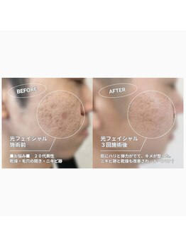 イエナ(IENA)/大流行中のメンズ美容はIENAで