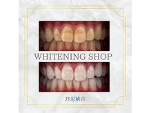 ホワイトニングショップ 尼崎店の雰囲気（おタバコによるヤニ汚れも落ちます！#ホワイトニング#尼崎）