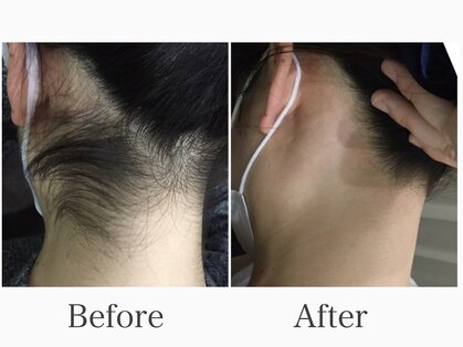 ハダハダ(HADA HADA Medical Esthetic)の写真