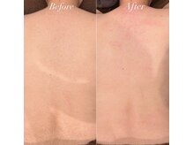 ジョエルワックス 沖縄那覇店(JOELLE WAX)/自信の持てる背中へ♪