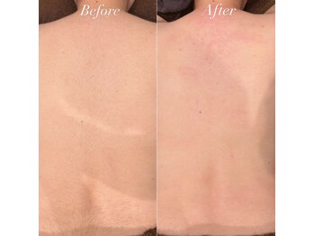 ジョエルワックス 沖縄那覇店(JOELLE WAX)/自信の持てる背中へ♪