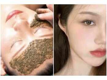 アリア(alia)/バーブピーリング韓国リフト顔首