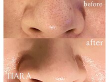 ティアラ 錦糸町(TIARA)/