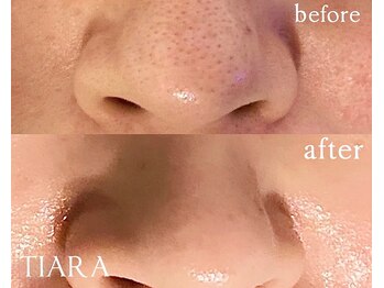 ティアラ 錦糸町(TIARA)/