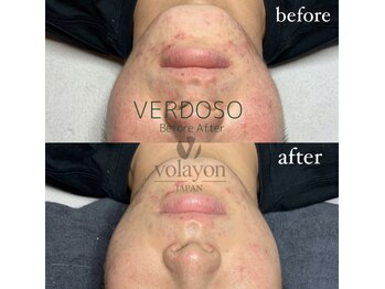 ペイジ(peige)/【peige】症例写真