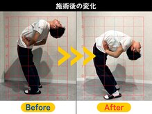 西巣鴨駅前整体院/☆施術ビフォーアフター☆